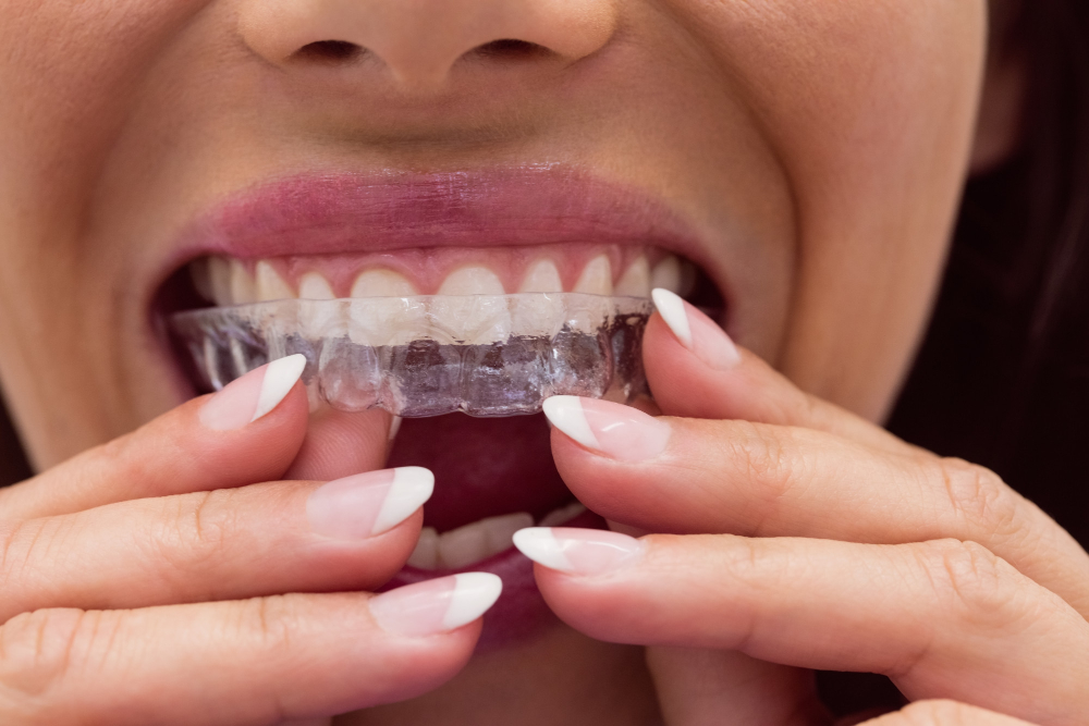 gnatologia-dentista-modena-torrenova